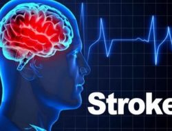 Pentingnya Memahami Ancaman Stroke dan Pencegahannya