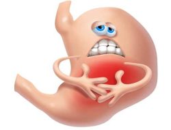 GERD dan Cara Mencegahnya