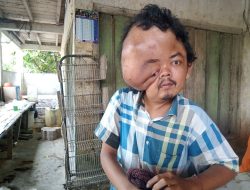 Viqri Gunawan, Penderita Tumor yang Membutuhkan Bantuan Para Dermawan