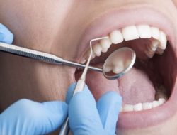 Scaling Gigi Gratis dengan BPJS Kesehatan, Ini Syarat dan Prosedurnya