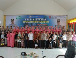Sentuhan Kemanusiaan di Hari Bhayangkara ke-80: Polres Nagan Raya Fasilitasi Operasi Bibir Sumbing Gratis bagi 15 Warga