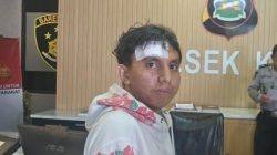 Pemuda Asal Sumba Mengaku Dijebak Lowongan Kerja Palsu di Bali, Disekap hingga Kabur Bersimbah Darah