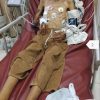 Yatim Piatu dan Sakit Parah di Bali, Tengku Erlangga Butuh Uluran Tangan untuk Pengobatan dan Pulang ke Sumatera Utara