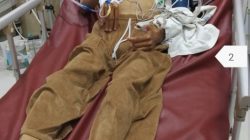 Yatim Piatu dan Sakit Parah di Bali, Tengku Erlangga Butuh Uluran Tangan untuk Pengobatan dan Pulang ke Sumatera Utara