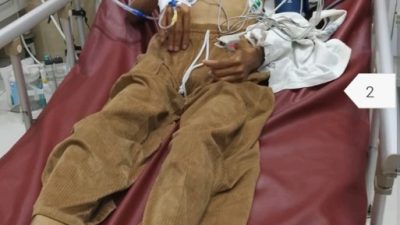 Yatim Piatu dan Sakit Parah di Bali, Tengku Erlangga Butuh Uluran Tangan untuk Pengobatan dan Pulang ke Sumatera Utara