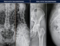 RSUD Kota Tanjungpinang Klarifikasi Dugaan Malpraktik, Sebut Penanganan Pasien Sesuai Standar Medis